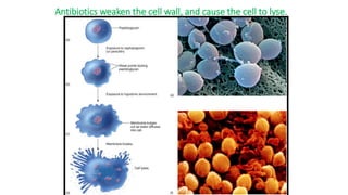Antibiotics weaken the cell wall, and cause the cell to lyse.
 