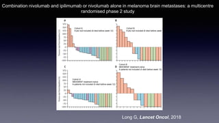 Combined Nivolumab and Ipilimumab in Melanoma Metastatic to the Brain