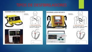 TIPOS DE DESFIBRILADORES
 
