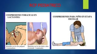 RCP PEDIATRICO
 