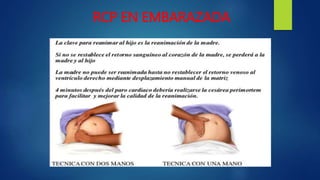 RCP EN EMBARAZADA
 