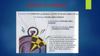 TIEMPO ES CEREBRO
 