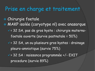 Prise en charge et traitement
 Chirurgie foetale
 MAKP isolée (caryotype nl) avec anasarque
< 32 SA, pas de gros kyste : chirurgie materno-
foetale ouverte (survie postnatale = 50%)
< 32 SA, un ou plusieurs gros kystes : drainage
pleuro-amniotique (survie 75%)
> 32 SA : naissance programmée +/- EXIT
procedure (survie 89%)
 