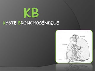 KB
KYSTE BRONCHOGÉNIQUE
 