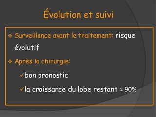 Évolution et suivi
 Surveillance avant le traitement: risque
évolutif
 Après la chirurgie:
bon pronostic
la croissance du lobe restant ≈ 90%
 