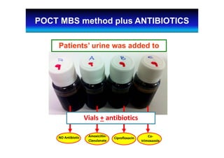 Co‐
trimoxazole
Vials + antibiotics
Amoxicillin‐
Clavulanate
CiprofloxacinNO Antibiotic
POCT MBS method plus ANTIBIOTICS
Patients’ urine was added to
 
