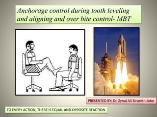 1
Anchorage control during tooth leveling
and aligning and over bite control- MBT
TO EVERY ACTION, THERE IS EQUAL AND OPPOSITE REACTION
PRESENTED BY: Dr. Zynul Ali Sirsmith John
 