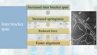Inter bracket
span
Increased inter bracket span
Increased springiness
Reduced force
Faster alignment
17
 