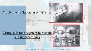 Problem with Superelastic NiTi
Crimp split tube segment to prevent
sliding excessively
20
•Wiiliam R Proffit textbook of comtemporary orthodontics Fifth edition
 