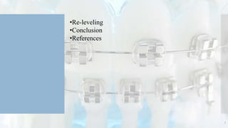 3
•Re-leveling
•Conclusion
•References
 