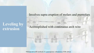 Leveling by
extrusion
Involves supra eruption of molars and premolars
Accomplished with continuous arch wire
41
•Wiiliam R Proffit textbook of comtemporary orthodontics Fifth edition
 