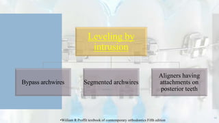 45
Leveling by
intrusion
Bypass archwires Segmented archwires
Aligners having
attachments on
posterior teeth
•Wiiliam R Proffit textbook of comtemporary orthodontics Fifth edition
 