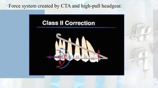 Force system created by CTA and high-pull headgear.
53
 
