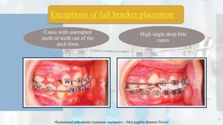 72
•Systemized orthodontic treatment mechanics – McLaughlin Bennett Trevisi
Exceptions of full bracket placement
 Cases with unerupted
teeth or teeth out of the
arch form
 High angle deep bite
cases
 