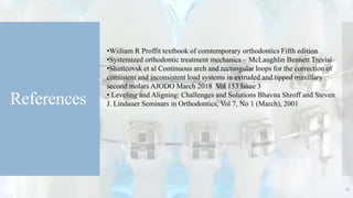 References
75
•Wiiliam R Proffit textbook of comtemporary orthodontics Fifth edition
•Systemized orthodontic treatment mechanics – McLaughlin Bennett Trevisi
•Shintcovsk et al Continuous arch and rectangular loops for the correction of
consistent and inconsistent load systems in extruded and tipped maxillary
second molars AJODO March 2018 Vol 153 Issue 3
• Leveling and Aligning: Challenges and Solutions Bhavna Shroff and Steven
J. Lindauer Seminars in Orthodontics, Vol 7, No 1 (March), 2001
 