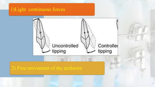 1)Light continuous forces
2) Free movement of the archwire
9
 