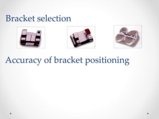 Bracket selection
Accuracy of bracket positioning
 