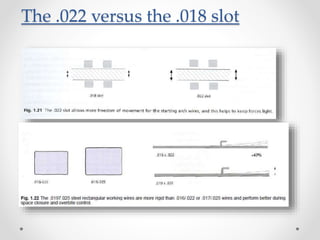 The .022 versus the .018 slot
 