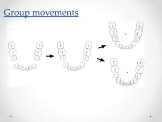 Group movements
 