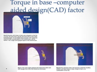 Torque in base –computer
aided design(CAD) factor
 