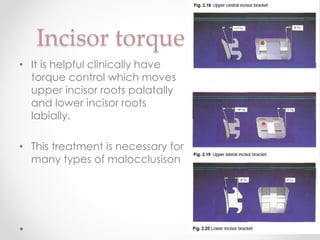 Incisor torque
• It is helpful clinically have
torque control which moves
upper incisor roots palatally
and lower incisor roots
labially.
• This treatment is necessary for
many types of malocclusison
 
