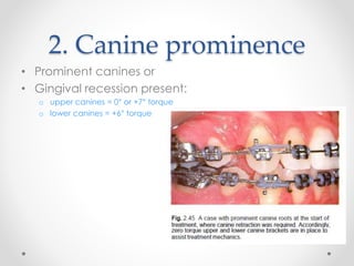 2. Canine prominence
• Prominent canines or
• Gingival recession present:
o upper canines = 0° or +7° torque
o lower canines = +6° torque
 