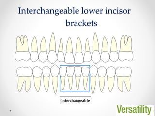 51
Interchangeable lower incisor
brackets
Interchangeable
 