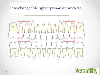 Interchangeable upper premolar brackets
 