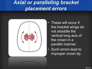 Axial or paralleling bracket
placement errors
• These will occur if
the bracket wings do
not straddle the
vertical long axis of
the crown in a
parallel manner.
• Such errors lead to
improper crown tip.
 