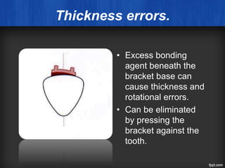 Thickness errors.
• Excess bonding
agent beneath the
bracket base can
cause thickness and
rotational errors.
• Can be eliminated
by pressing the
bracket against the
tooth.
 