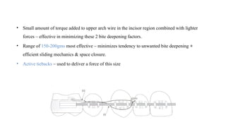 mbt - systemized orthodontic treatment mechanics part 2.pptx