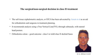mbt - systemized orthodontic treatment mechanics part 2.pptx