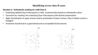 mbt - systemized orthodontic treatment mechanics part 2.pptx