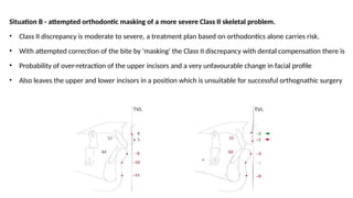mbt - systemized orthodontic treatment mechanics part 2.pptx