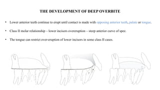 mbt - systemized orthodontic treatment mechanics part 2.pptx
