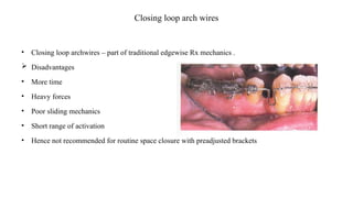 mbt - systemized orthodontic treatment mechanics part 2.pptx
