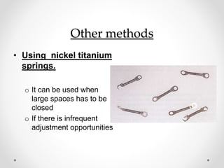 Other methods
• Using nickel titanium
springs.
o It can be used when
large spaces has to be
closed
o If there is infrequent
adjustment opportunities
 