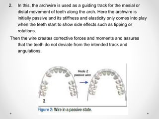 2. In this, the archwire is used as a guiding track for the mesial or
distal movement of teeth along the arch. Here the archwire is
initially passive and its stiffness and elasticity only comes into play
when the teeth start to show side effects such as tipping or
rotations.
Then the wire creates corrective forces and moments and assures
that the teeth do not deviate from the intended track and
angulations.
 