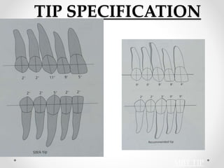 TIP SPECIFICATION
MBT TIP
 