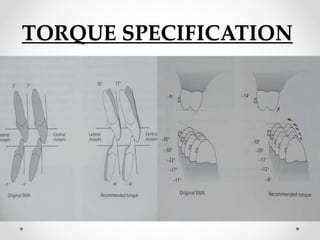 TORQUE SPECIFICATION
 
