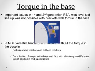 Torque in the base
• Important issues in 1st and 2nd generation PEA was level slot
line up was not possible with brackets with torque in the face
• In MBT versatile brackets are finished with all the torque in
the base in
• Full size metal brackets and esthetic brackets
• Combination of torque in the base and face with absolutely no difference
in slot position in mid size brackets
 