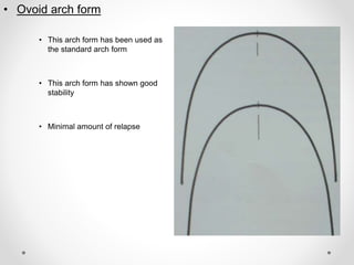 • Ovoid arch form
• This arch form has been used as
the standard arch form
• This arch form has shown good
stability
• Minimal amount of relapse
 