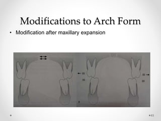 63
• Modification after maxillary expansion
Modifications to Arch Form
 
