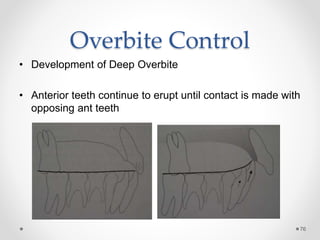 76
Overbite Control
• Development of Deep Overbite
• Anterior teeth continue to erupt until contact is made with
opposing ant teeth
 