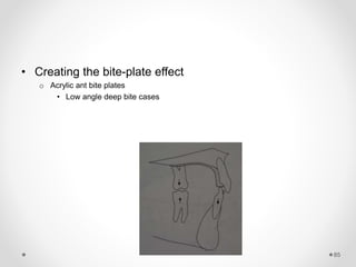 85
• Creating the bite-plate effect
o Acrylic ant bite plates
• Low angle deep bite cases
 