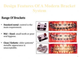 MBT -systemized orthodontic treatment mechanics.pptx