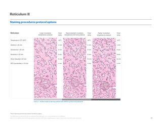 Reticulum II
Staining procedures protocol options
Figure 2 - Sample images of staining achieved with different protocol ti...