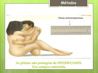 Métodos
                          Hormonais

                         Pílulas anticoncepcionais




As pílulas não protegem de DST/HIV/AIDS.
           Use sempre camisinha
 