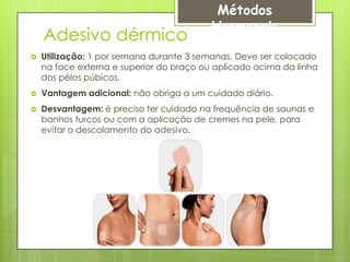 Métodos
                                          Hormonais
    Adesivo dérmico
   Utilização: 1 por semana durante 3 semanas. Deve ser colocado
    na face externa e superior do braço ou aplicado acima da linha
    dos pêlos púbicos.
   Vantagem adicional: não obriga a um cuidado diário.
   Desvantagem: é preciso ter cuidado na frequência de saunas e
    banhos turcos ou com a aplicação de cremes na pele, para
    evitar o descolamento do adesivo.
 