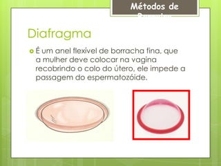 Métodos de
                           Barreira

Diafragma
É um anel flexível de borracha fina, que
 a mulher deve colocar na vagina
 recobrindo o colo do útero, ele impede a
 passagem do espermatozóide.
 
